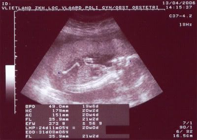 13 april 2006, 20-weken scan