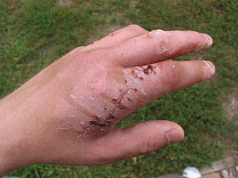 [Linked Image from i21.photobucket.com]